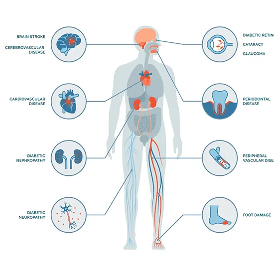 Diabetes Mellitus : The Pandemic Of The Century